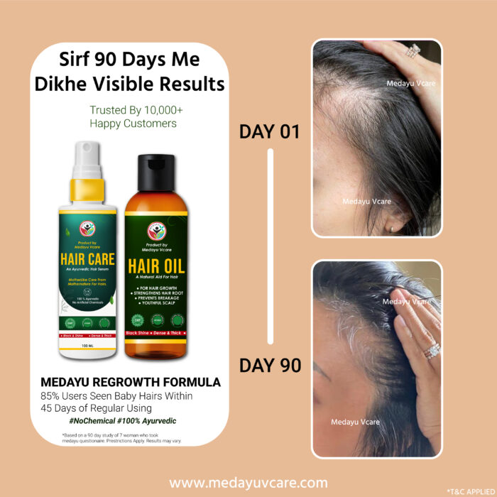 Anti-Hairfall Combo - Image 2